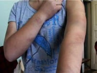 Воспитатель избил девочку. Шокирующий случай в толебийском детском доме № 2