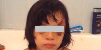 Жестоко избитую матерью девочку в Шымкенте вернули в семью