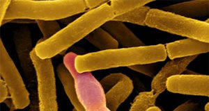 Диагноз «сибирская язва» в ЮКО не подтвердился