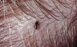 Креолин — смерть