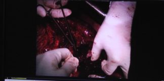 Продажа органов на черном рынке в Казахстане набирает обороты