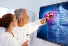 Остеопороз — тихая эпидемия XXI века