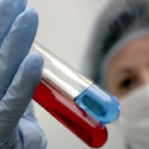 Все пятеро зараженных коронавирусом — жители Жетысайского района