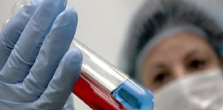 «Свиной грипп» подтвердился у 37 жителей Южного Казахстана