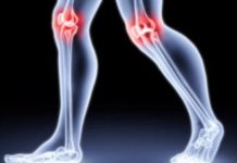 В Шымкенте работает коллегия ревматологов В Шымкенте работает коллегия ревматологов