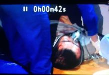 Пешеход, пострадавший от удара спецмашиной, в тяжелом состоянии доставлен в больницу