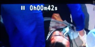 Пешеход, пострадавший от удара спецмашиной, в тяжелом состоянии доставлен в больницу