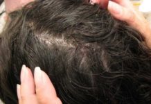 К чему может привести халатность школьного медика