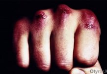 В Шымкенте парни избили девушек