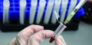 Где можно пройти бесплатный экспресс-тест на коронавирус