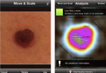 Мобильное приложение для профилактики рака кожи станет доступно казахстанцам Мобильное приложение для профилактики рака кожи станет доступно казахстанцам