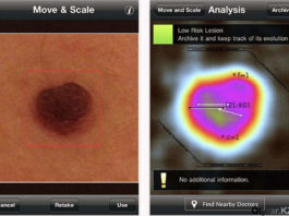 Мобильное приложение для профилактики рака кожи станет доступно казахстанцам