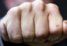 Житель России неадекватно вел себя в одном из банков Шымкента: Он сломал зуб охраннику