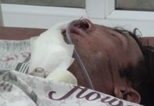 Установлена личность мужчины, попавшего в больницу в результате огнестрельного ранения в лицо