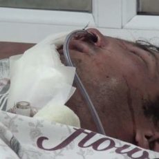 Установлена личность мужчины, попавшего в больницу в результате огнестрельного ранения в лицо