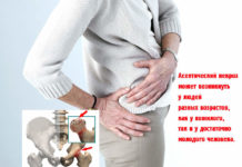 Чем опасен инфаркт суставов, рассказывает специалист Чем опасен инфаркт суставов