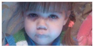 За два дня Qiwi-счет для помощи Виоле Балан увеличился на 200 тысяч тенге