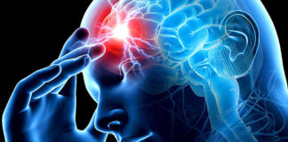 Инсульт становится моложе