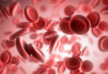 Осторожно: анемия!