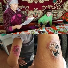 В ЮКО существует три природных очага лейшманиоза