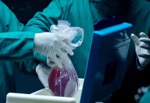 Что не так с посмертным донорством в Казахстане В Шымкенте донор остался без почки и без денег