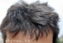 Ученые выяснили, как ранняя седина связана с долголетием Седина волос