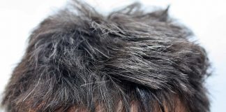 Ученые выяснили, как ранняя седина связана с долголетием Седина волос