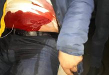 Поножовщиной закончились посиделки в караоке Шымкента