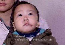 В Шымкенте мальчику, рожденному с ухом на щеке, нужна операция Ребенку требуется операция
