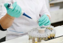 Сальмонеллез: Шымкент, Бишкек и кошки Швеции Пробы на сальмонеллез в лаборатории