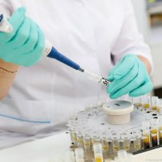 Сургутские медики подтвердили, что корь привезли из Шымкента Пробы на сальмонеллез в лаборатории