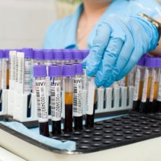 COVID 19 обнаружили у 51-летнего жителя Шымкента лабораторные анализы