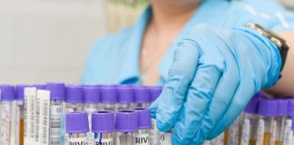 COVID 19 обнаружили у 51-летнего жителя Шымкента лабораторные анализы