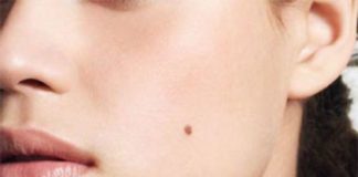 О чем рассказывают родинки на вашем лице