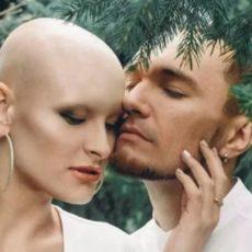 Лысая модель из Павлодара ищет похожих на себя для фотосессии Лысая модель