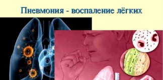 За прошедшие сутки в Казахстане выявлены 79 заболевших коронавирусом пневмония