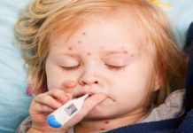 Лекарств нет, от кори спасет только вакцинация — врачи