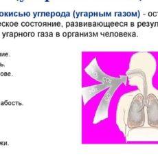 Симптомы отравления угарным газом