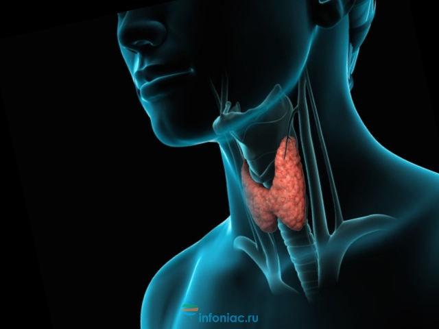Рак щитовидной железы фото шеи