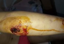 По предписаниям мачехи, падчерицы должны были сами выбирать себе наказания мать издевалась над детьми