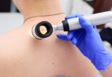 Онкоцентр Шымкента приглашает жителей на день открытых дверей рак кожи, родинки