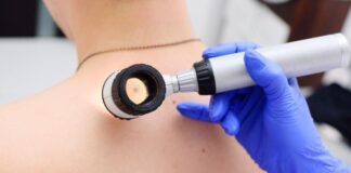 Онкоцентр Шымкента приглашает жителей на день открытых дверей рак кожи, родинки