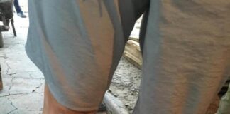 Житель Арыси пострадал от взрыва, который произошел, когда мужчина сжигал бытовой мусор