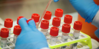 Казахстанка скончалась от коронавируса