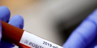 В стране подтверждены 435 случаев регистрации коронавируса Коронавирус. COVID-19