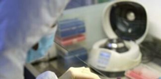 В Акмолинской области зарегистрирована еще одна смерть от коронавируса коронавирус