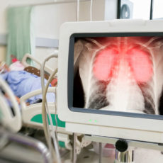 Что известно о третьем скончавшемся от COVID-19 пациенте в Шымкенте ИВЛ