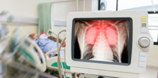 Что известно о третьем скончавшемся от COVID-19 пациенте в Шымкенте ИВЛ