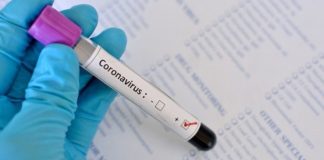 Коронавирус в РК: За прошедшие сутки выявлено 1558 заболевших