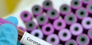 В Туркестанской области зарегистрировано 29 случаев коронавируса Коронавирус. COVID-19